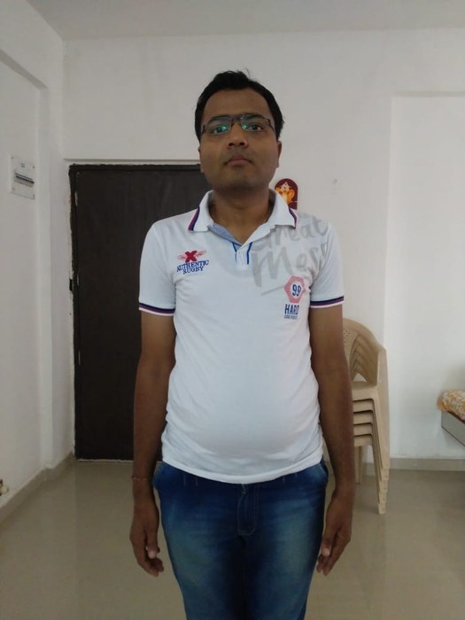 Before - 7 kg Weight Loss